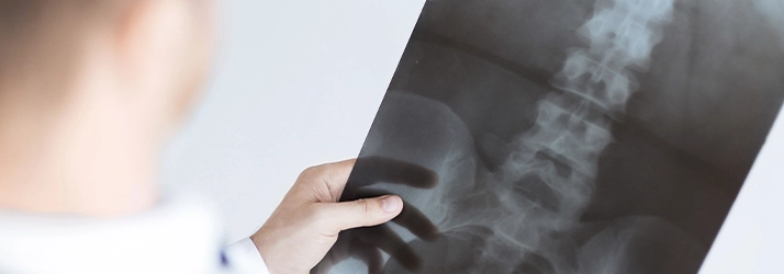 Why Do We Take X-Rays in Centennial CO?